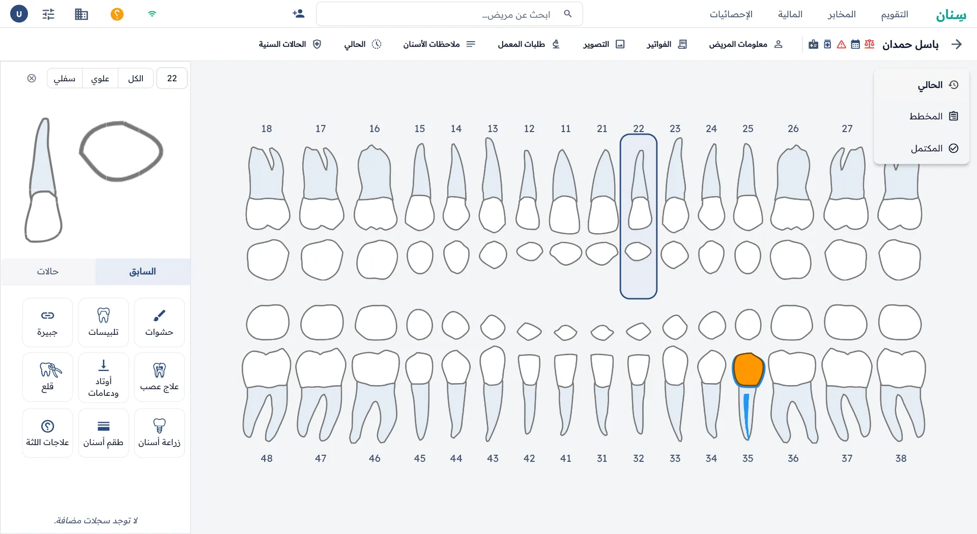 Sinan - FDI Dental Charting